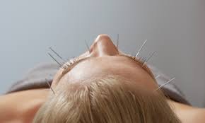 Enjoy Being Acupuncture